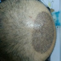 發(fā)際線用戶圖片