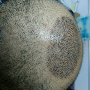 发际线分享社区