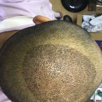 發(fā)際線用戶圖片