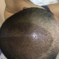 發(fā)際線用戶圖片