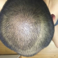 發(fā)際線用戶圖片