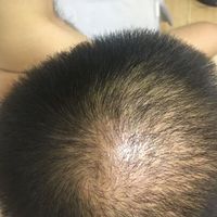發(fā)際線用戶圖片