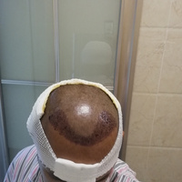 發(fā)際線用戶圖片