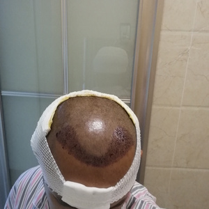 发际线分享社区