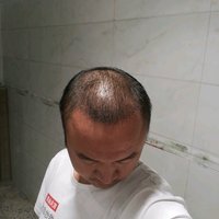 發(fā)際線用戶圖片