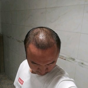 发际线分享社区
