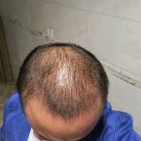 發(fā)際線用戶圖片