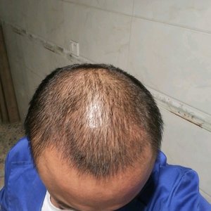 发际线分享社区