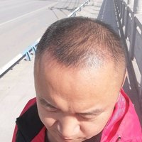 發(fā)際線用戶圖片