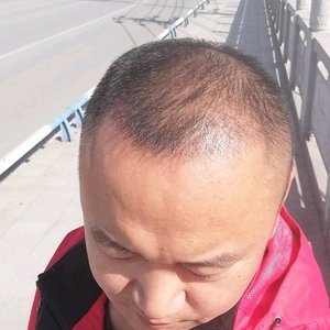 发际线分享社区