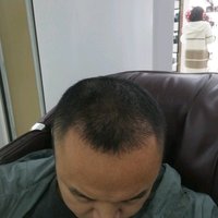 發(fā)際線用戶圖片
