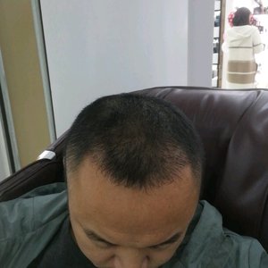 发际线分享社区