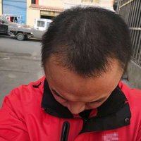 發(fā)際線用戶圖片