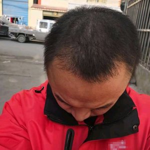发际线分享社区