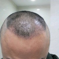 發(fā)際線用戶圖片