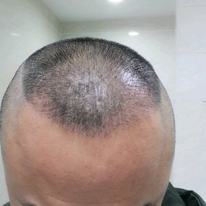 发际线分享社区