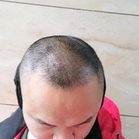 發(fā)際線用戶圖片