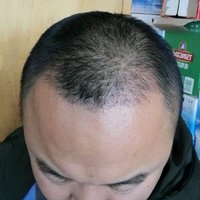 發(fā)際線用戶圖片