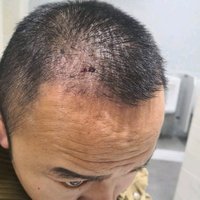發(fā)際線用戶圖片