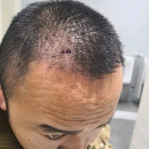 发际线分享社区