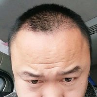 發(fā)際線用戶圖片