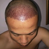 發(fā)際線用戶圖片