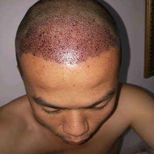 发际线分享社区