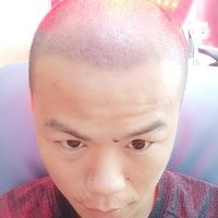 發(fā)際線用戶圖片