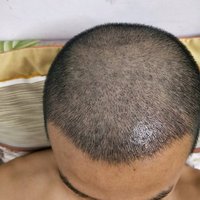 發(fā)際線用戶圖片