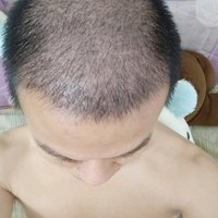 發(fā)際線用戶圖片