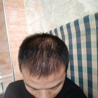 發(fā)際線用戶圖片
