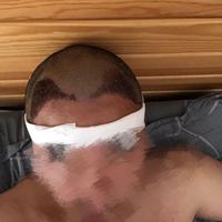 發(fā)際線用戶圖片