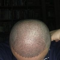 發(fā)際線用戶圖片