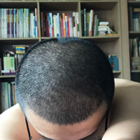 發(fā)際線用戶圖片