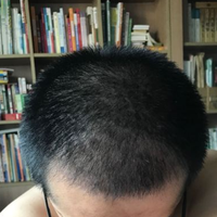 發(fā)際線用戶圖片