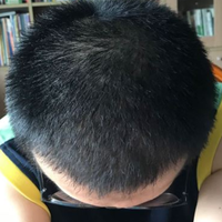 發(fā)際線用戶圖片