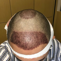 發(fā)際線用戶圖片