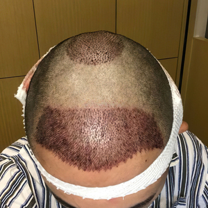 发际线分享社区