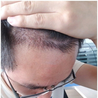 發(fā)際線用戶圖片