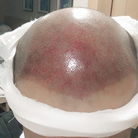 發(fā)際線用戶圖片