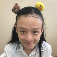 發(fā)際線用戶圖片