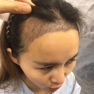 发际线分享社区