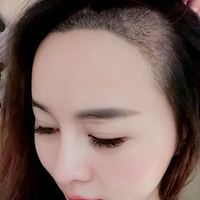 發(fā)際線用戶圖片