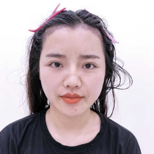 发际线分享社区