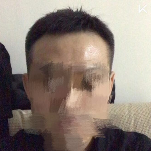 发际线分享社区