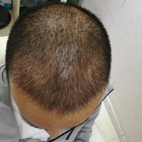 發(fā)際線用戶圖片