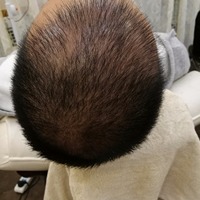 發(fā)際線用戶圖片