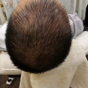 发际线分享社区