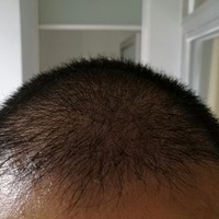 發(fā)際線用戶圖片