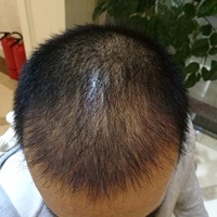 發(fā)際線用戶圖片